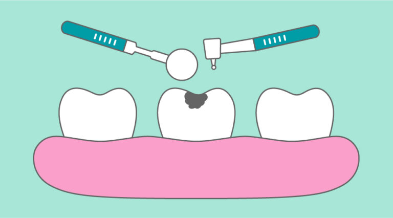 Dentista realizando un empaste dental a una paciente en la clínica DentalCompany