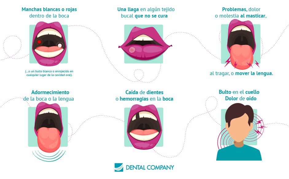 Síntomas Cáncer Oral