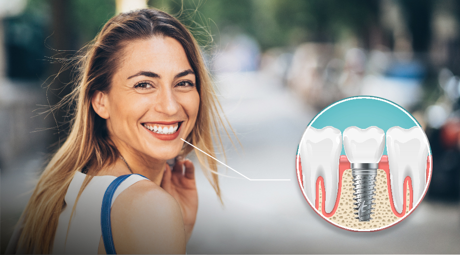 Dentista explicando los cuidados necesarios tras colocar implantes dentales a un paciente