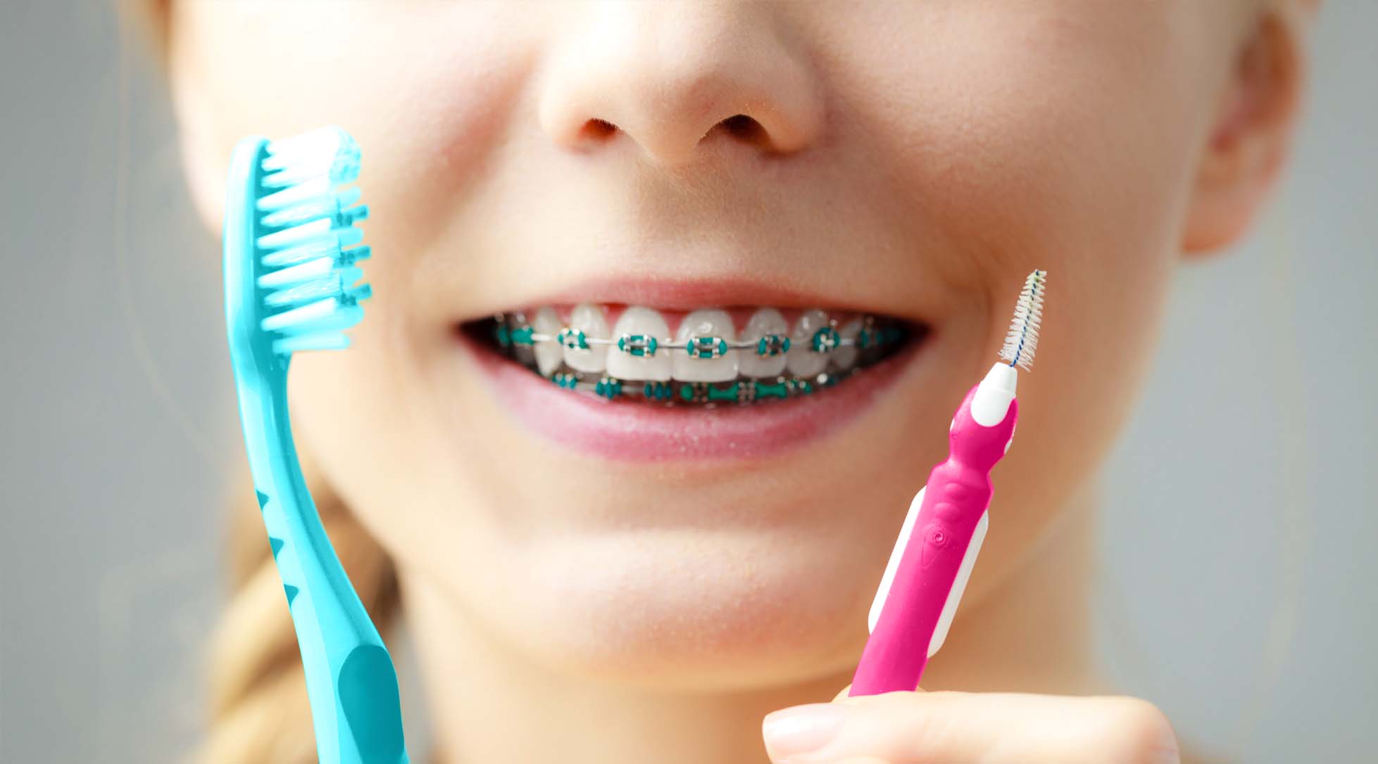 Joven sonriendo mientras se cepilla los dientes con brackets siguiendo la técnica correcta