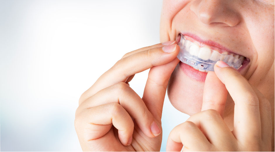 Férula dental de descarga para pacientes con bruxismo e implantes dentales