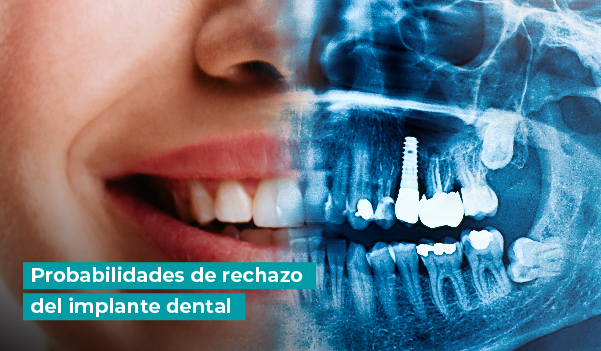 Probabilidades de rechazo del implante dental
