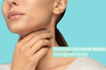 Síntomas cáncer de boca