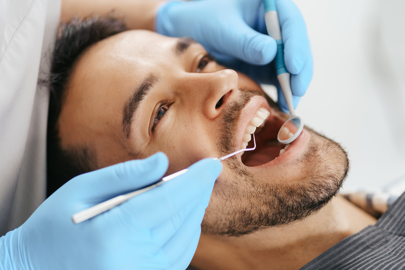 sarro-dental-negro-eliminarlo