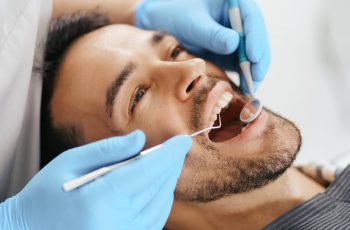sarro-dental-negro-eliminarlo