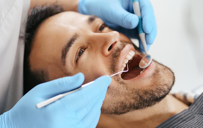 sarro-dental-negro-eliminarlo