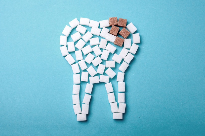 muela con caries profunda