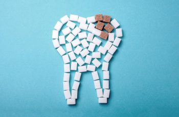 muela con caries profunda