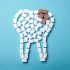 muela con caries profunda