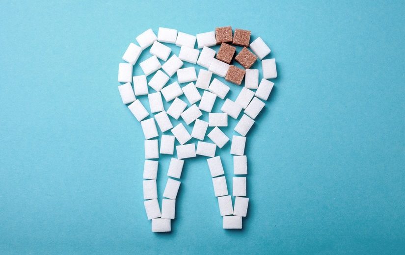 muela con caries profunda