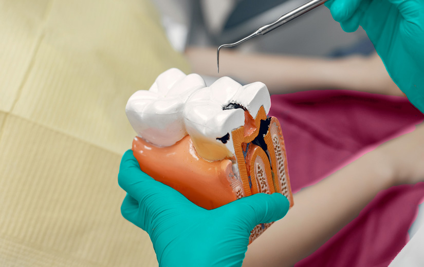 tipos-de-empastes-dentales
