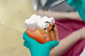 tipos-de-empastes-dentales