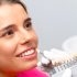 requisitos-para-ponerse-carillas-dentales