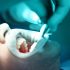 como-se-hace-una-endodoncia