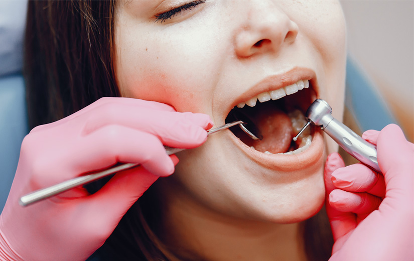tartrectomia-dental