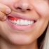 periodontitis-avanzada