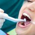 incrustaciones-dentales