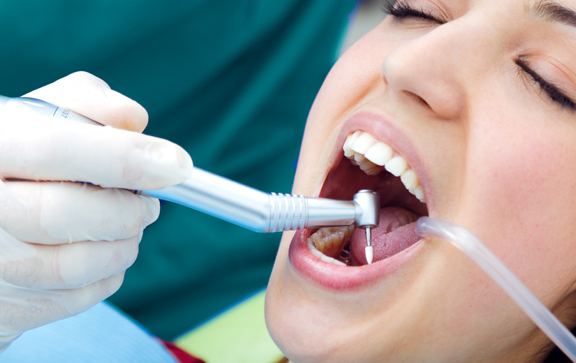incrustaciones-dentales