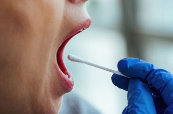examen con exceso de saliva