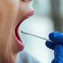 examen con exceso de saliva