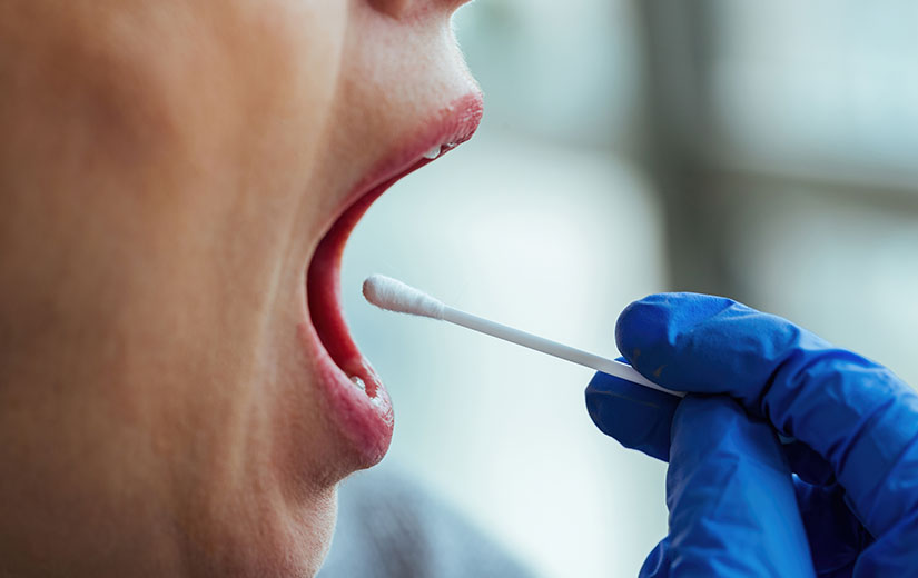 examen con exceso de saliva