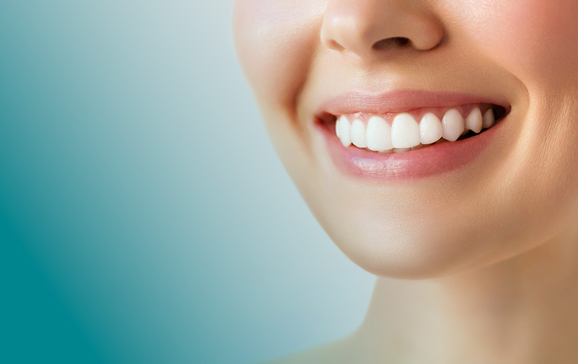 ventajas-carillas-sin-tallado