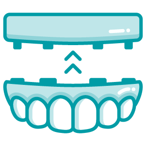 Prótesis sobre implantes