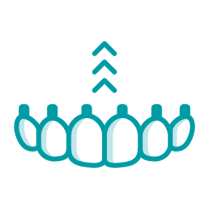 Prótesis dental fija