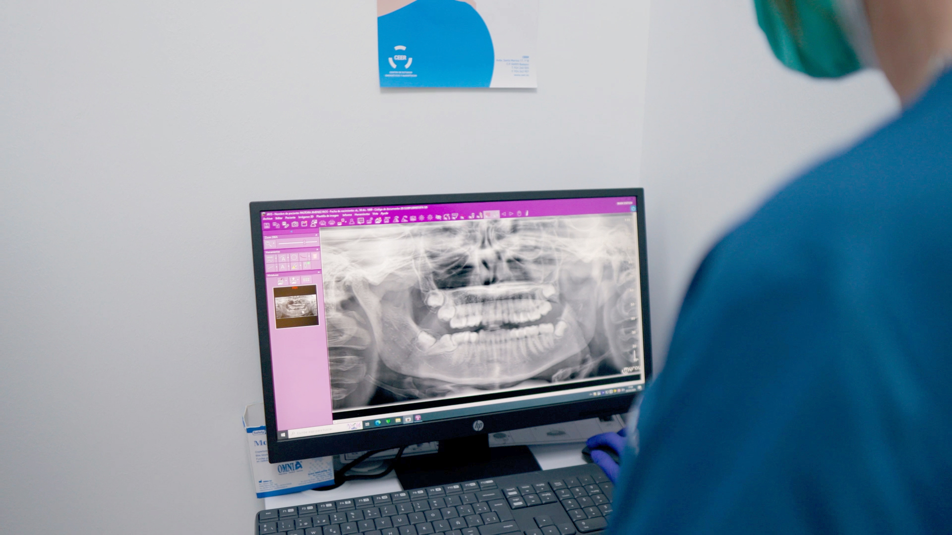 Dentista revisando radiografía panorámica en pantalla