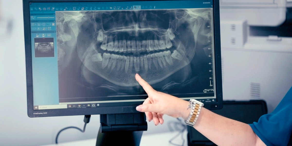 Dentista señalando radiografía panorámica en pantalla