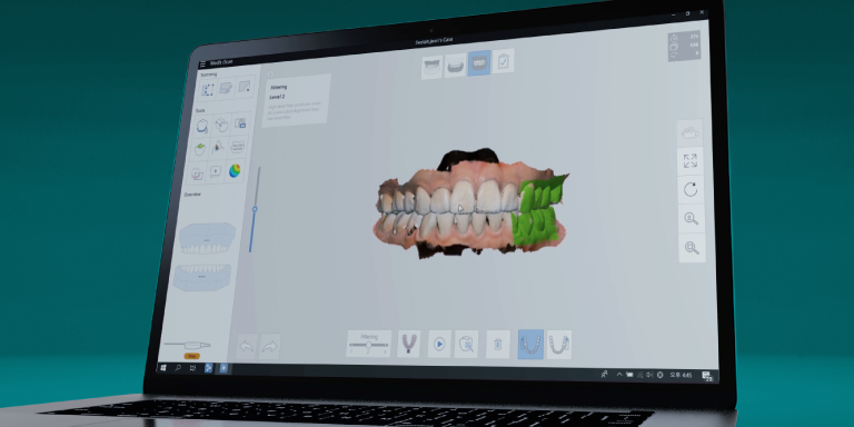 Ordenador con software de diseño dental asistido por ordenador