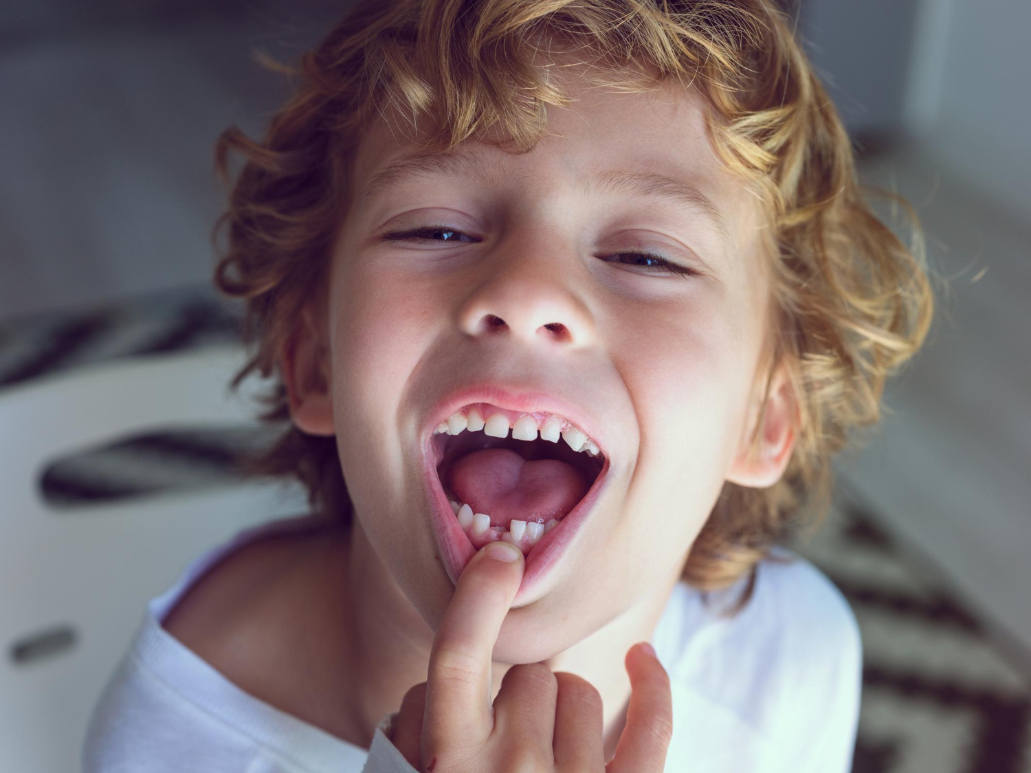 Cuándo se caen los dientes de leche: edades y orden